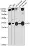 Deoxycytidine kinase antibody, GTX32553, GeneTex, Western Blot image 