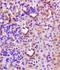 Cytochrome P450 Family 3 Subfamily A Member 4 antibody, orb13361, Biorbyt, Immunohistochemistry paraffin image 