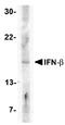 Interferon Beta 1 antibody, AP05706PU-N, Origene, Western Blot image 