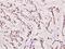 ATR Interacting Protein antibody, A03862-1, Boster Biological Technology, Immunohistochemistry paraffin image 