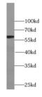 YES Proto-Oncogene 1, Src Family Tyrosine Kinase antibody, FNab09563, FineTest, Western Blot image 