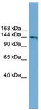 DCC Netrin 1 Receptor antibody, TA339003, Origene, Western Blot image 