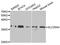 ADP/ATP translocase 1 antibody, TA332454, Origene, Western Blot image 