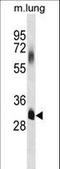 Elongation of very long chain fatty acids protein 7 antibody, LS-C167740, Lifespan Biosciences, Western Blot image 