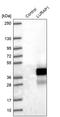 Leucine Rich Adaptor Protein 1 antibody, PA5-56328, Invitrogen Antibodies, Western Blot image 