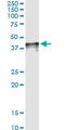 Ccn3 antibody, LS-B6407, Lifespan Biosciences, Immunoprecipitation image 
