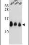 NADH:Ubiquinone Oxidoreductase Subunit C2 antibody, PA5-24234, Invitrogen Antibodies, Western Blot image 