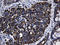 Mitochondrial Ribosomal Protein L48 antibody, LS-C795647, Lifespan Biosciences, Immunohistochemistry paraffin image 