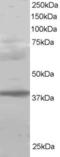 Polycomb group RING finger protein 2 antibody, EB05955, Everest Biotech, Western Blot image 