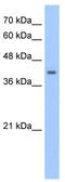 1-Aminocyclopropane-1-Carboxylate Synthase Homolog (Inactive) antibody, TA346852, Origene, Western Blot image 
