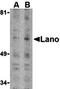 Leucine Rich Repeat Containing 1 antibody, orb74467, Biorbyt, Western Blot image 