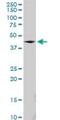 SS18 Subunit Of BAF Chromatin Remodeling Complex antibody, H00006760-B01P, Novus Biologicals, Western Blot image 
