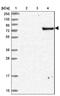 Armadillo Like Helical Domain Containing 3 antibody, NBP2-30398, Novus Biologicals, Western Blot image 