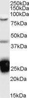 Nucleolysin TIA-1 isoform p40 antibody, GTX89059, GeneTex, Western Blot image 