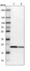 Signal Peptidase Complex Subunit 2 antibody, NBP1-93656, Novus Biologicals, Western Blot image 