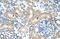 RNA Binding Motif Protein 38 antibody, ARP40862_P050, Aviva Systems Biology, Immunohistochemistry paraffin image 