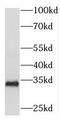RAD52 Motif Containing 1 antibody, FNab07221, FineTest, Western Blot image 