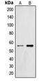 Zinc Finger And SCAN Domain Containing 26 antibody, LS-C353021, Lifespan Biosciences, Western Blot image 