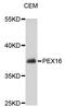 Peroxisomal Biogenesis Factor 16 antibody, STJ113610, St John
