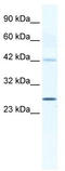 Gap Junction Protein Beta 4 antibody, TA341676, Origene, Western Blot image 