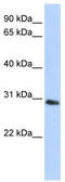Bisphosphoglycerate mutase antibody, TA344412, Origene, Western Blot image 