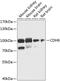 Cadherin-6 antibody, GTX33279, GeneTex, Western Blot image 