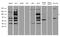 DNA Methyltransferase 3 Beta antibody, A00319-1, Boster Biological Technology, Western Blot image 
