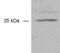 Monoglyceride Lipase antibody, ab24701, Abcam, Western Blot image 