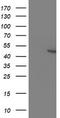 Potassium Voltage-Gated Channel Subfamily A Member Regulatory Beta Subunit 1 antibody, TA503967S, Origene, Western Blot image 
