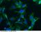 Doublecortin antibody, 13498-MM01T, Sino Biological, Immunohistochemistry frozen image 