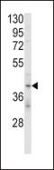 Killer cell immunoglobulin-like receptor 2DL4 antibody, 63-756, ProSci, Western Blot image 