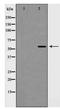 Protein Inhibitor Of Activated STAT 4 antibody, TA347977, Origene, Western Blot image 