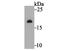 NADH dehydrogenase [ubiquinone] iron-sulfur protein 4, mitochondrial antibody, A03608-1, Boster Biological Technology, Western Blot image 