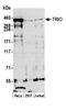 Trio Rho Guanine Nucleotide Exchange Factor antibody, A304-269A, Bethyl Labs, Western Blot image 