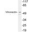 Vitronectin antibody, LS-C200054, Lifespan Biosciences, Western Blot image 