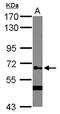 Polypeptide N-Acetylgalactosaminyltransferase 14 antibody, LS-C155712, Lifespan Biosciences, Western Blot image 