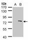 Zinc Finger MYND-Type Containing 11 antibody, NBP2-20960, Novus Biologicals, Western Blot image 