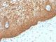Keratin 14 antibody, V2668IHC-7ML, NSJ Bioreagents, Immunohistochemistry frozen image 