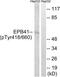 Erythrocyte Membrane Protein Band 4.1 antibody, LS-C198921, Lifespan Biosciences, Western Blot image 