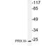 Peroxiredoxin 3 antibody, LS-C177533, Lifespan Biosciences, Western Blot image 