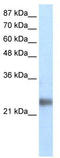 RING finger protein 114 antibody, TA331847, Origene, Western Blot image 