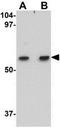 Matrilin 1 antibody, GTX85289, GeneTex, Western Blot image 