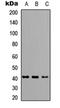 Fibroblast Growth Factor 4 antibody, orb234843, Biorbyt, Western Blot image 
