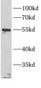 Armadillo repeat-containing protein 5 antibody, FNab00585, FineTest, Western Blot image 