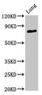Ataxin-7 antibody, CSB-PA002445LA01HU, Cusabio, Western Blot image 