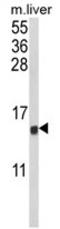 C-C Motif Chemokine Ligand 3 antibody, AP17929PU-N, Origene, Western Blot image 
