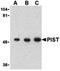 Golgi-associated PDZ and coiled-coil motif-containing protein antibody, orb74665, Biorbyt, Western Blot image 