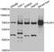 5'-Aminolevulinate Synthase 1 antibody, A6521, ABclonal Technology, Western Blot image 