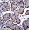 Ribosomal Protein L23 antibody, LS-C162704, Lifespan Biosciences, Immunohistochemistry paraffin image 