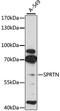 SprT-Like N-Terminal Domain antibody, LS-C747060, Lifespan Biosciences, Western Blot image 